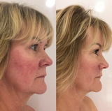 Crème Rescue Serum | PMU & Microblading Aftercare